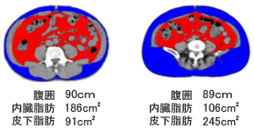 内臓脂肪
