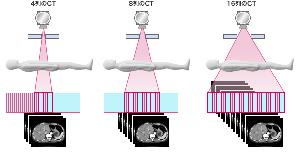 4列のCT／8列のCT／16列のCT