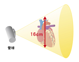 医科用CTもコーンビーム